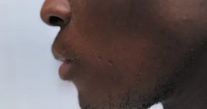 Horizontal video: Close up video of a person applying cream on face 5891044. Duration: 25 seconds. Resolution: 4096x2160
